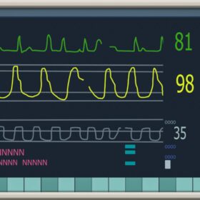 patient-monitor-showing-vital-signs-ecg-ekg-vector-illustration-2-2-600x450